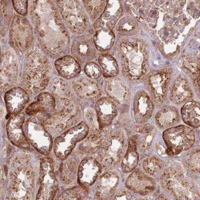 Immunohistochemistry: Ankyrin Repeat Domain 24 Antibody [NBP2-30929]