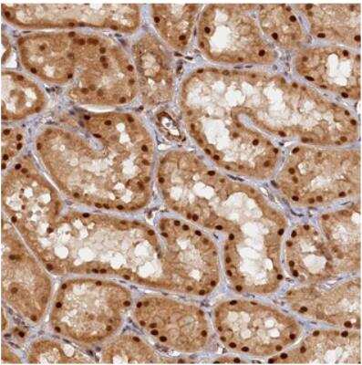 Immunohistochemistry-Paraffin: Ankyrin Repeat Domain 24 Antibody [NBP2-31027]