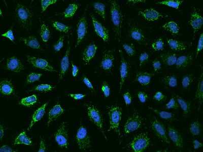 Immunocytochemistry/ Immunofluorescence: Ankyrin Repeat Domain 33B Antibody [NBP2-98013]