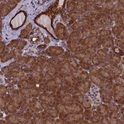 Immunohistochemistry-Paraffin: Ankyrin repeat domain 39 Antibody [NBP1-91673]