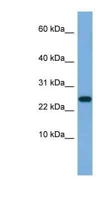 Western Blot: Ankyrin repeat domain 39 Antibody [NBP1-79652]