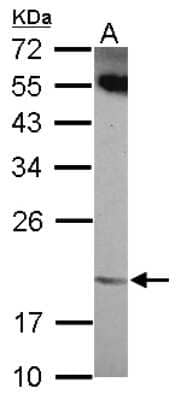 Western Blot: Ankyrin repeat domain 39 Antibody [NBP2-15402]