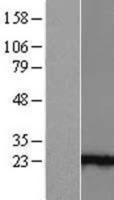 Western Blot: Ankyrin repeat domain 39 Overexpression Lysate [NBL1-07541]