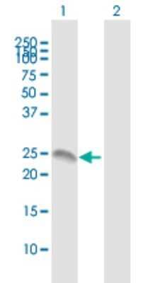 Western Blot: Annexin 2 Receptor Antibody [H00389289-B01P]