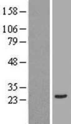 Western Blot: Annexin 2 Receptor Overexpression Lysate [NBL1-08496]