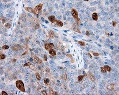Immunohistochemistry-Paraffin: Annexin A1 Antibody (OTI3A8) [NBP2-02357]