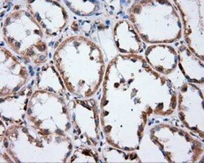 Immunohistochemistry-Paraffin: Annexin A1 Antibody (OTI3A8) [NBP2-02357]