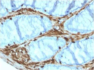 Immunohistochemistry-Paraffin: Annexin A1 Antibody (ANXA1/3566) [NBP3-07716]