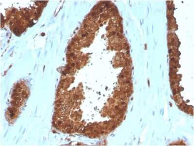 Immunohistochemistry-Paraffin: Annexin A1 Antibody (ANXA1/3566) - Azide and BSA Free [NBP3-08708]