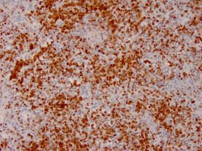 Immunohistochemistry-Paraffin: Annexin A1 Antibody (ANXA1/3566) - Azide and BSA Free [NBP3-08708]