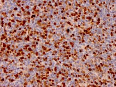 Immunohistochemistry-Paraffin: Annexin A1 Antibody (ANXA1/3566) - Azide and BSA Free [NBP3-08708]