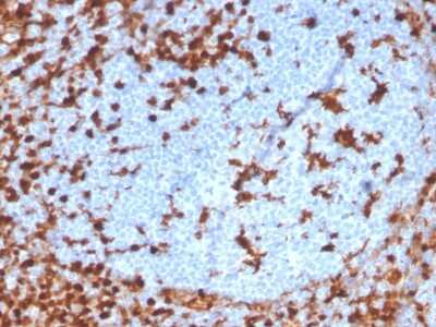 Immunohistochemistry-Paraffin: Annexin A1 Antibody (ANXA1/3869R) [NBP3-07717]