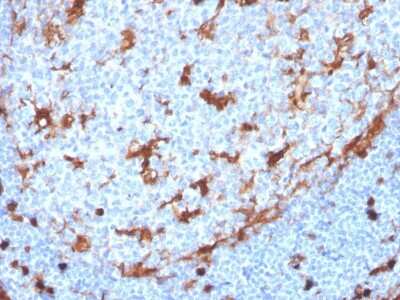 Immunohistochemistry-Paraffin: Annexin A1 Antibody (ANXA1/3869R) [NBP3-07717]