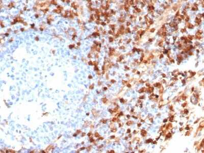 Immunohistochemistry-Paraffin: Annexin A1 Antibody (ANXA1/6452R) [NBP3-13935]