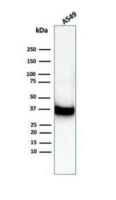 Western Blot: Annexin A1 Antibody (ANXA1/6452R) [NBP3-13935]