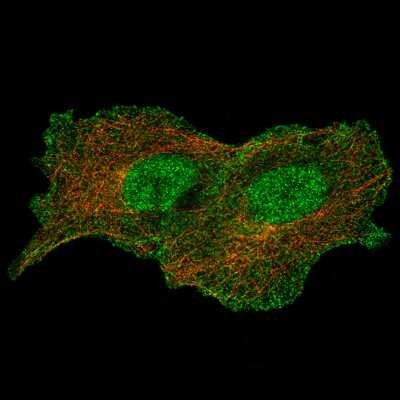Immunocytochemistry/ Immunofluorescence: Annexin A1 Antibody (CL0199) [NBP2-52875]