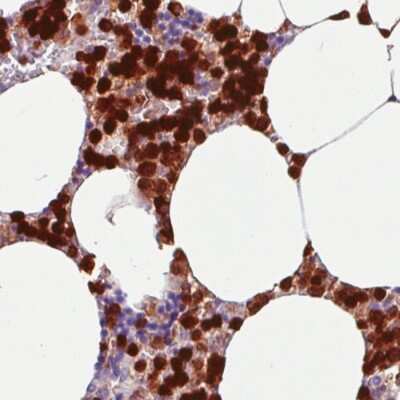 Immunohistochemistry-Paraffin: Annexin A1 Antibody (CL0199) [NBP2-52875]