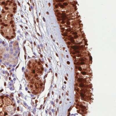 Immunohistochemistry-Paraffin: Annexin A1 Antibody (CL0199) [NBP2-52875]