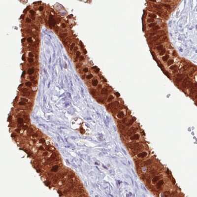 Immunohistochemistry-Paraffin: Annexin A1 Antibody (CL0199) [NBP2-52875]