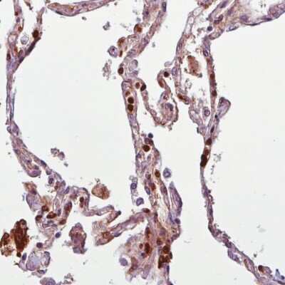 Immunohistochemistry-Paraffin: Annexin A1 Antibody (CL0199) [NBP2-52875]