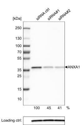 Western Blot: Annexin A1 Antibody (CL0199) [NBP2-52875]