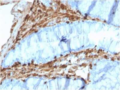Immunohistochemistry-Paraffin: Annexin A1 Antibody (CPTC-ANXA1-1) - Azide and BSA Free [NBP3-08699]