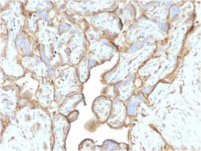 Immunohistochemistry-Paraffin: Annexin A1 Antibody (CPTC-ANXA1-1) [NBP3-07714]