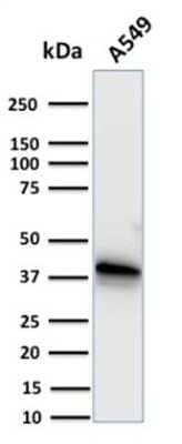 Western Blot: Annexin A1 Antibody (CPTC-ANXA1-1) [NBP3-07714]