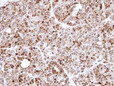 Immunohistochemistry-Paraffin: Annexin A1 Antibody [NBP1-33684]