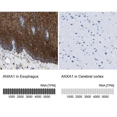 Immunohistochemistry-Paraffin: Annexin A1 Antibody [NBP1-90161]