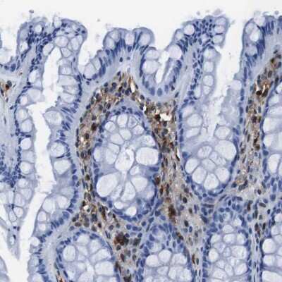Immunohistochemistry-Paraffin: Annexin A1 Antibody [NBP1-90161]