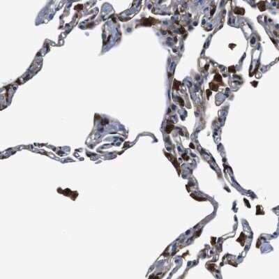 Immunohistochemistry-Paraffin: Annexin A1 Antibody [NBP1-90161]