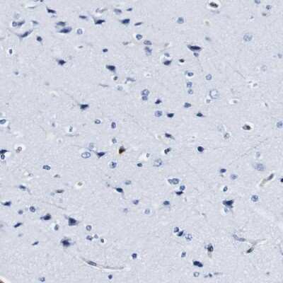Immunohistochemistry-Paraffin: Annexin A1 Antibody [NBP1-90161]