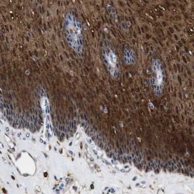 Immunohistochemistry-Paraffin: Annexin A1 Antibody [NBP1-90161]