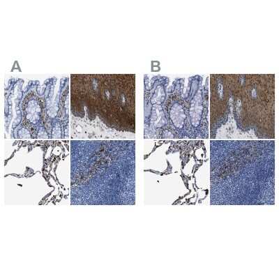Immunohistochemistry-Paraffin: Annexin A1 Antibody [NBP1-90161]