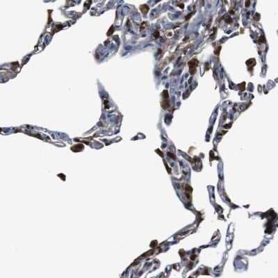 Immunohistochemistry-Paraffin: Annexin A1 Antibody [NBP1-90162]
