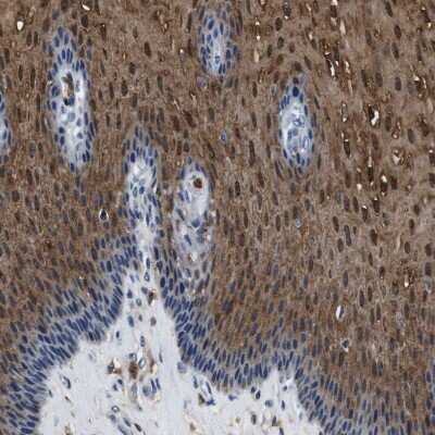 Immunohistochemistry-Paraffin: Annexin A1 Antibody [NBP1-90162]