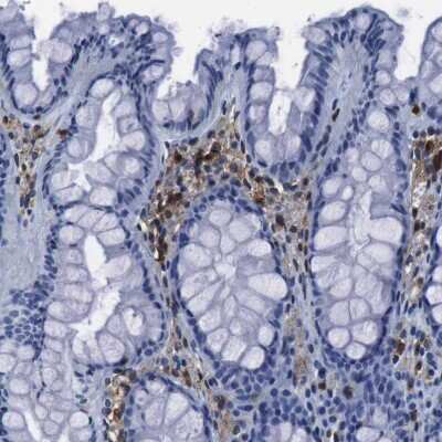 Immunohistochemistry-Paraffin: Annexin A1 Antibody [NBP1-90162]