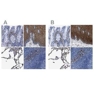 Immunohistochemistry-Paraffin: Annexin A1 Antibody [NBP1-90162]
