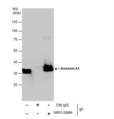 Immunoprecipitation: Annexin A1 Antibody [NBP1-33684]