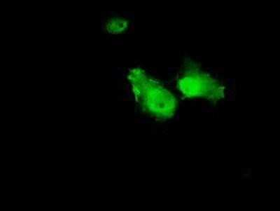Immunocytochemistry/ Immunofluorescence: Annexin A1 Antibody (OTI3A8) - Azide and BSA Free [NBP2-70174]