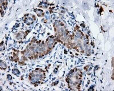 Immunohistochemistry: Annexin A1 Antibody (OTI3A8) - Azide and BSA Free [NBP2-70174]