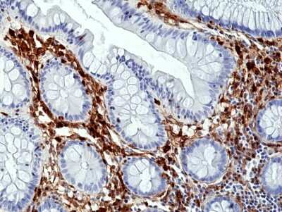 Immunohistochemistry-Paraffin: Annexin A1 Antibody (RM424) [NBP3-09177]
