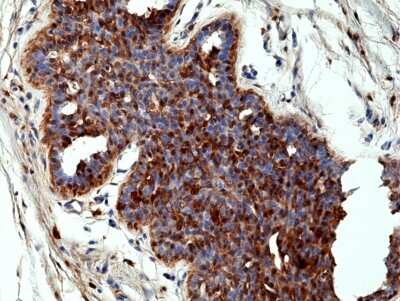 Immunohistochemistry-Paraffin: Annexin A1 Antibody (RM424) [NBP3-09177]