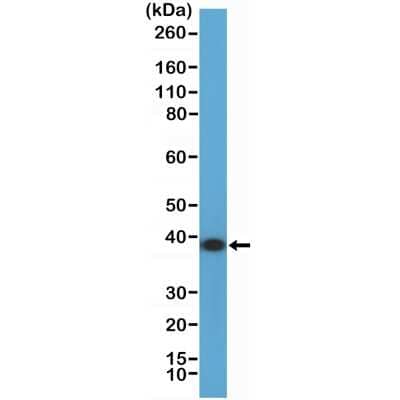 Western Blot: Annexin A1 Antibody (RM424) [NBP3-09177]