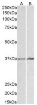 Western Blot: Annexin A1 Antibody [NBP1-18842]