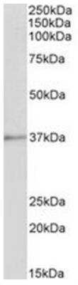 Western Blot: Annexin A1 Antibody [NBP1-18842]