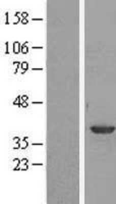 Western Blot: Annexin A1 Overexpression Lysate [NBL1-07557]