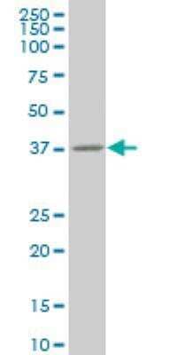 Western Blot: Annexin A10 Antibody (4G12) [H00011199-M03]