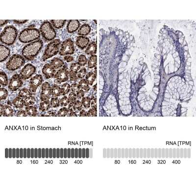 Immunocytochemistry/ Immunofluorescence: Annexin A10 Antibody [NBP3-16992]